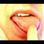 MOUTH HERPES from SHANE DAWSON!!?